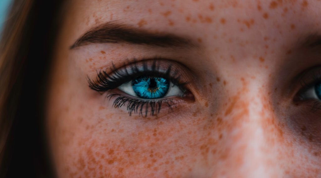 blue eye with freckles